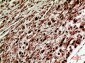 SRY Polyclonal Antibody