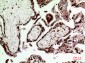 SRY Polyclonal Antibody