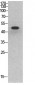 p53 Polyclonal Antibody