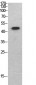 p53 Polyclonal Antibody