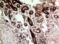 p53 Polyclonal Antibody