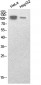 SREBP-1 Polyclonal Antibody