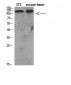 SREBP-1 Polyclonal Antibody