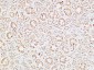 IGFBP3 Polyclonal Antibody