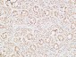 IGFBP3 Polyclonal Antibody