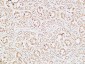 IGFBP3 Polyclonal Antibody