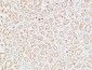 IGFBP3 Polyclonal Antibody