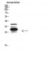 IGFBP3 Polyclonal Antibody