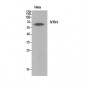 Netrin-1 Polyclonal Antibody