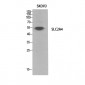 Glut4 Polyclonal Antibody