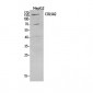 COL5A2 Polyclonal Antibody