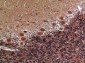 COL5A2 Polyclonal Antibody