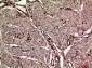 OAS2 Polyclonal Antibody