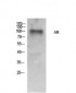 AR Polyclonal Antibody