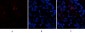 AR Polyclonal Antibody