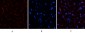 AR Polyclonal Antibody