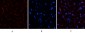 AR Polyclonal Antibody