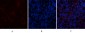 AR Polyclonal Antibody