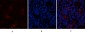 AR Polyclonal Antibody
