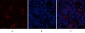 AR Polyclonal Antibody