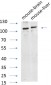 AR Polyclonal Antibody