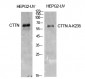 Cortactin Polyclonal Antibody