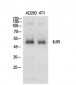 IL-6Rα Polyclonal Antibody