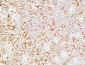 M-CSF Polyclonal Antibody