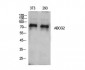 ABCG2 Polyclonal Antibody