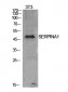 AAT Polyclonal Antibody