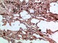 AAT Polyclonal Antibody