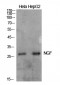 NGF Polyclonal Antibody