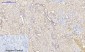 NGF Polyclonal Antibody