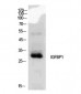 IGFBP1 Polyclonal Antibody