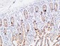 IL-3Rα Polyclonal Antibody