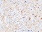 IL-3Rα Polyclonal Antibody