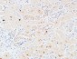 IL-3Rα Polyclonal Antibody