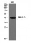 PSGL-1 Polyclonal Antibody