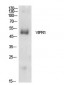 VPAC1 Polyclonal Antibody