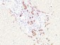 CD19 Polyclonal Antibody