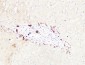 CD19 Polyclonal Antibody