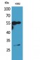 CD20 Polyclonal Antibody