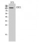 CD21 Polyclonal Antibody