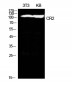 CD21 Polyclonal Antibody