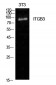 Integrin β3 Polyclonal Antibody