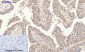 Integrin β3 Polyclonal Antibody