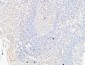 VE-Cadherin Polyclonal Antibody