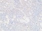 VE-Cadherin Polyclonal Antibody