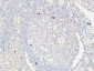 VE-Cadherin Polyclonal Antibody