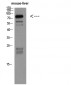 VE-Cadherin Polyclonal Antibody